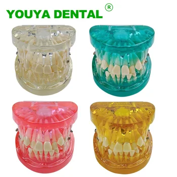 Zobni Ortodontskega Model Pregleden Zob Malocclusion Model Za Bolnika Komunikacije Zobozdravstvo Zobozdravnik Poučevanja, Študijski Model